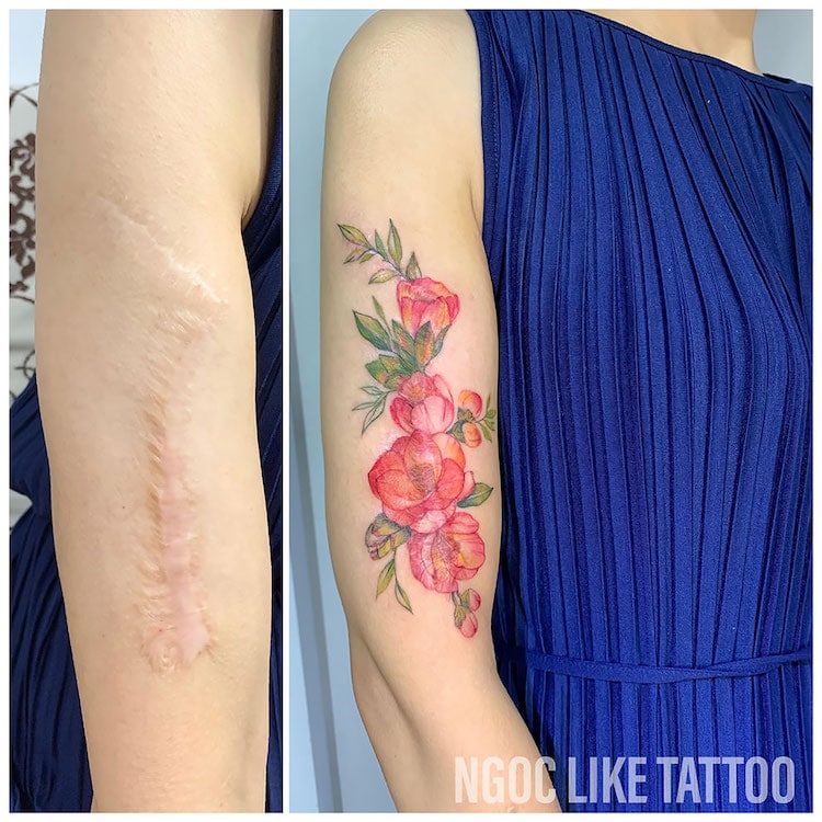 Scar Cover Up Tattoos by Ngoc Like Tattoo