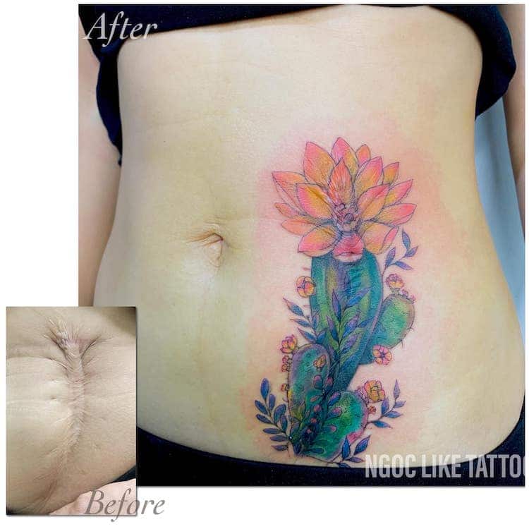 Scar Cover Up Tattoos by Ngoc Like Tattoo