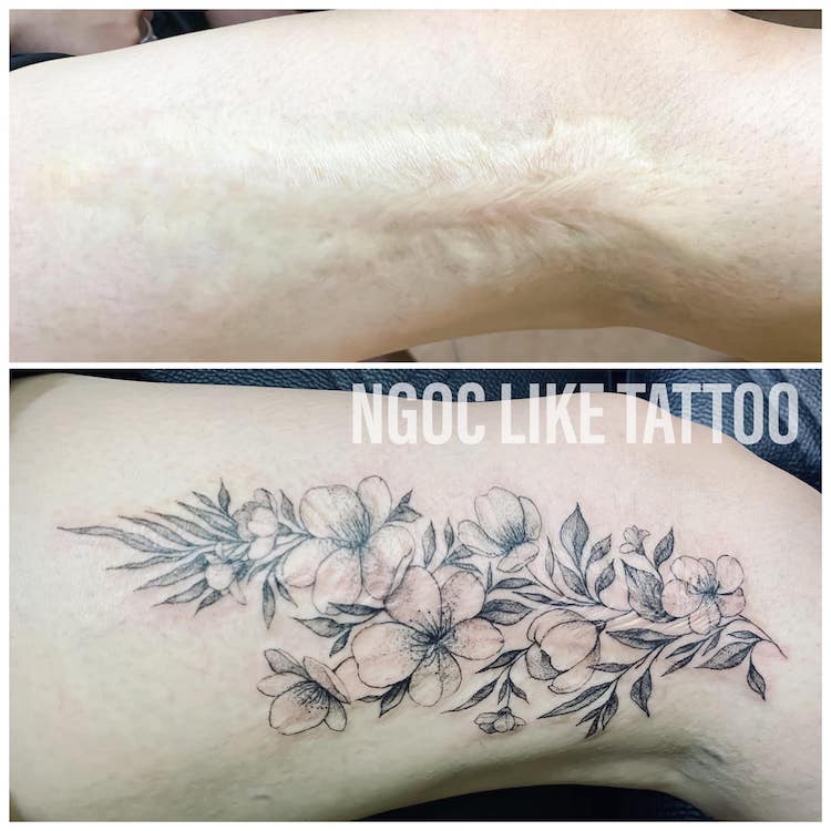 Scar Cover Up Tattoos by Ngoc Like Tattoo