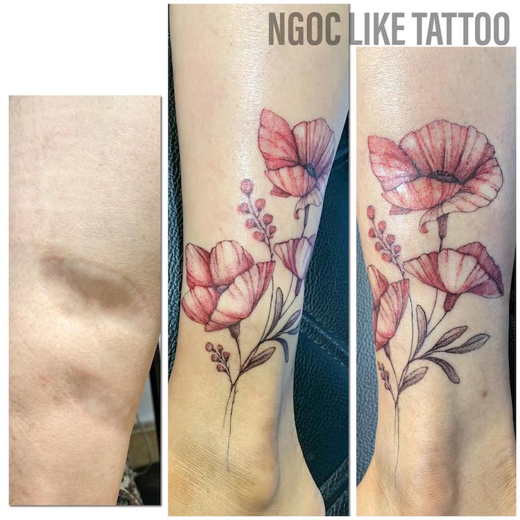 Scar Cover Up Tattoos by Ngoc Like Tattoo