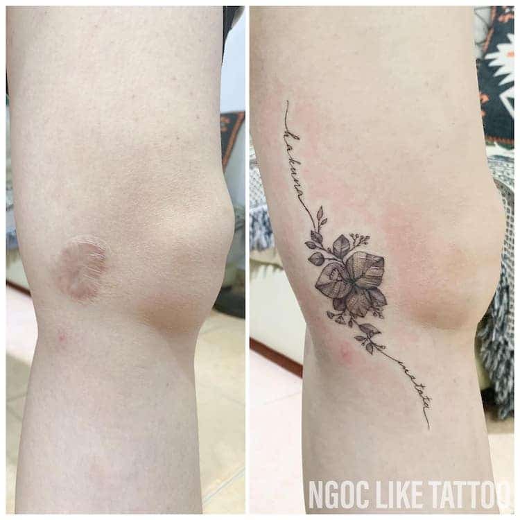 Scar Cover Up Tattoos by Ngoc Like Tattoo