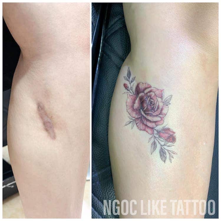 Scar Cover Up Tattoos by Ngoc Like Tattoo