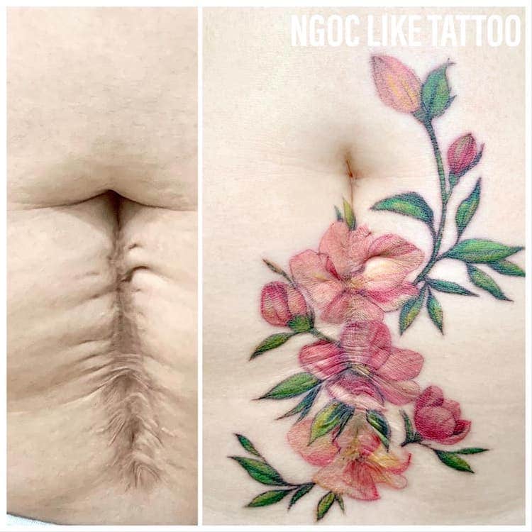 Scar Cover Up Tattoos by Ngoc Like Tattoo