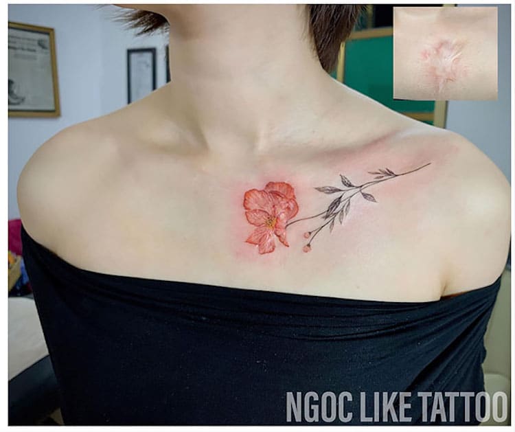 Scar Cover Up Tattoos by Ngoc Like Tattoo