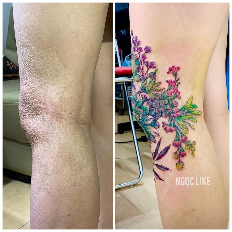 Scar Cover Up Tattoos by Ngoc Like Tattoo